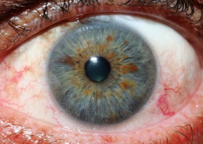 iridology constitutional
